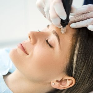 Dermapen skin needling